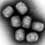 【国内初エムポックス死者】埼玉県の30代男性が感染