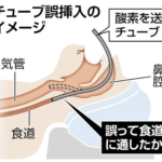 まさか「抜歯で亡くなるなんて…」支援学校生死亡の真相とは？